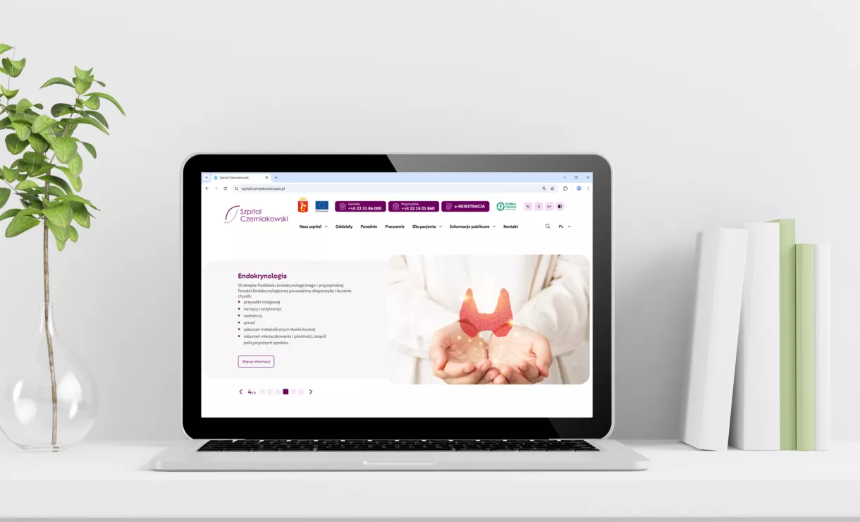 Laptop ze stroną główną Szpitala Czerniakowskiego