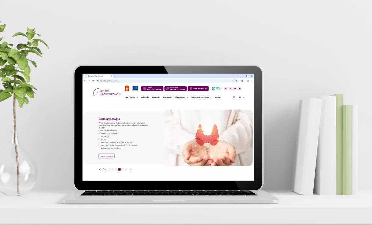 Laptop z otwartą stroną główną Szpitala Czerniakowskiego